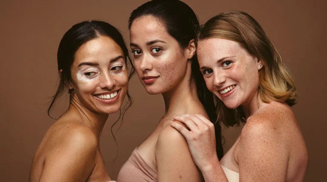 Seorang wanita mengoleskan serum vitamin C ke tangannya yang dipakai setiap hari.