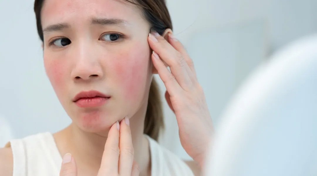 rekomendasi rangkaian lengkap skincare untuk kulit sensitif