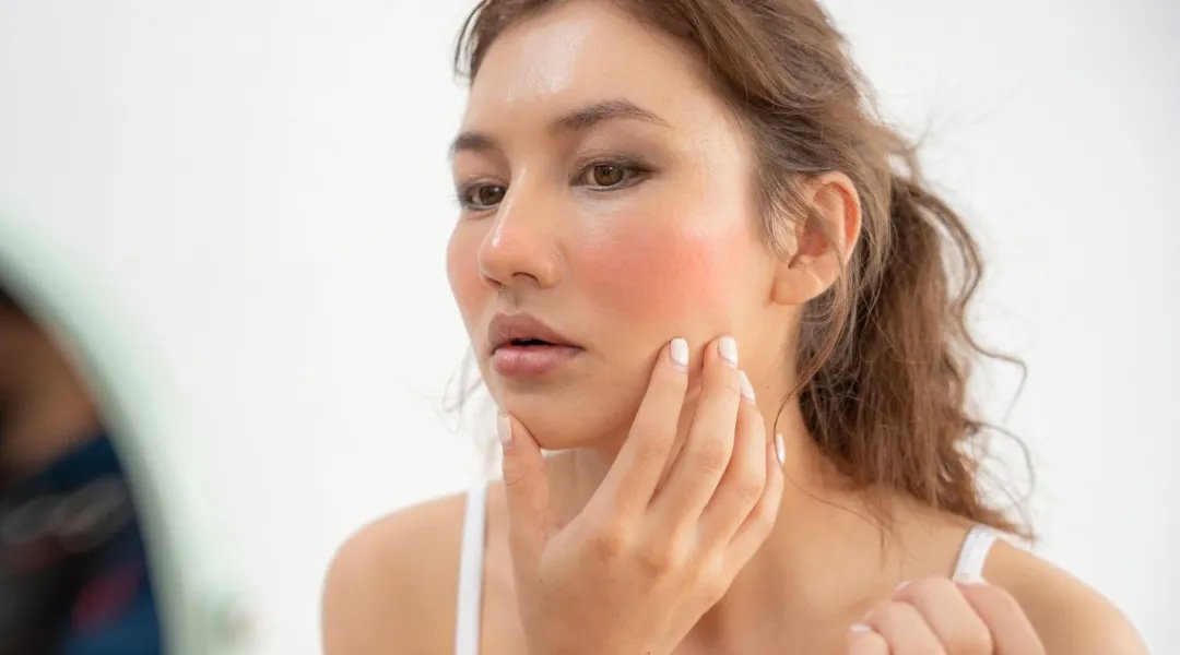 kenali ciri-ciri kulit sensitif melalui Spotscan+ dari La Roche-Posay