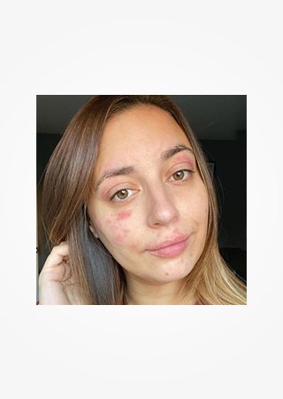 https://www.larocheposay.co.id/-/media/project/loreal/brand-sites/lrp/apac/id/simple-page/landing-page/brand-campaign/flip_card/flip_card-03.jpg