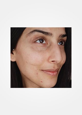 https://www.larocheposay.co.id/-/media/project/loreal/brand-sites/lrp/apac/id/simple-page/landing-page/brand-campaign/flip_card/flip_card-04.jpg
