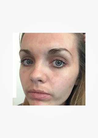 https://www.larocheposay.co.id/-/media/project/loreal/brand-sites/lrp/apac/id/simple-page/landing-page/brand-campaign/flip_card/flip_card-05.jpg